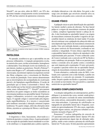 415
atividades laborativas e da vida diária. Em geral, a dor
surge com atividades que envolvem extensão ativa ou
flexão passiva do punho com o cotovelo em extensão.
Exame físico
A palpação inicia-se pela identificação dos epicôndi-
los lateral, medial e ponta do olécrano. Na face lateral
palpa-se a origem da musculatura extensora do punho
e dedos, complexo ligamentar lateral e cabeça do rá-
dio. A dor localizada no epicôndilo lateral e na origem
da musculatura extensora do punho é sugestiva de epi-
condilite lateral ou síndrome do túnel radial. O exame
deverá continuar com a palpação da cabeça do rádio em
uma depressão logo abaixo da musculatura extensora do
punho. Esta será realizada durante a pronossupinação,
em graus variáveis de flexoextensão, avaliando-se seu
contorno e integridade. O teste clínico específico para
a epicondilite lateral tem o objetivo de reproduzir a dor
experimentada pelo paciente. O teste conhecido como
de Cozen é realizado com o cotovelo em 90º de flexão e
com o antebraço em pronação. Pede-se ao paciente que
realize a extensão ativa do punho contra a resistência
que será imposta pelo examinador. O teste será positi-
vo quando o paciente referir dor no epicôndilo lateral,
origem da musculatura extensora do punho e dedos(9)
.
O teste alternativo, conhecido como de Mill, é rea-
lizado com o paciente com a mão fechada, o punho em
dorsiflexão e o cotovelo em extensão. O examinador,
então, forçará o punho em flexão e o paciente é orienta-
do a resistir ao movimento. Em caso positivo, o paciente
sentirá dor no epicôndilo lateral(9)
.
Exames complementares
A avaliação radiográfica em anteroposterior, perfil e
oblíquas é, na maioria das vezes, normal, sendo princi-
palmente útil para a exclusão de outras anormalidades
tais como artrose, osteocondrite dissecante e corpos li-
vres intra-articulares. A presença de calcificações na
topografia do epicôndilo lateral não é frequente, ocor-
rendo em aproximadamente 22% dos casos, sugerindo,
segundo alguns autores, um processo refratário ao tra-
tamento incruento (Figura 2)(8,10)
.
Pomerance(11)
avaliou radiografias do cotovelo de
271 pacientes com epicondilite lateral. Apenas 16% dos
pacientes apresentavam algum tipo de alteração radio-
gráfica, sendo a mais comum a presença de calcificação
lateral em 7% dos casos. Só dois pacientes apresentaram
Nirschl(5)
, em sua série, além do ERCC, em 35% dos
pacientes tratados cirurgicamente existia acometimento
de 10% da face anterior da aponeurose extensora.
Figura 1 – Desenho da anatomia da face lateral do cotovelo. O ERCC localiza-se
abaixo do ECD e ERLC.
Patologia
No passado, acreditava-se que a epicondilite era um
processo inflamatório. A inspeção peroperatória revela,
na maioria dos casos, tecidos acinzentados, homogêneos
e edemaciados. Essa alteração ocorre nas tendinoses, se-
jam laterais, mediais ou posteriores. Nirschl e Pettrone(3)
,
assim como Regan et al(6)
, utilizando avaliação através de
microscopia, encontraram rupturas na arquitetura normal
das fibras colágenas com o crescimento de fibroblas-
tos e tecido de granulação. Esses autores demonstraram
que as microrrupturas são acompanhadas de cicatrização
parcial e de hiperplasia angiofibroblástica. O tecido de
granulação que se forma é acinzentado e friável. Mas
cabe ressaltar que na fase inicial a epicondilite pode apre-
sentar sinais inflamatórios(3,6,7)
. Nirschl(8)
previamente
classificou em quatro estágios as lesões secundárias ao
microtrauma tendinoso na epicondilite lateral. O primeiro
estágio é inflamatório, reversível e sem alteração pato-
lógica. O segundo estágio é caracterizado pela degene-
ração angiofibroblástica. Já o terceiro é caracterizado
pela tendinose associada à alteração estrutural (ruptura
tendinosa). No quarto estágio, além das alterações deste
último, encontra-se a presença de fibrose e calcificação.
Diagnóstico
O diagnóstico é feito, basicamente, observando-se a
história do paciente e o exame clínico. A queixa principal é
a dor na região do epicôndilo lateral estendendo-se ao dor-
so do antebraço e a incapacidade para a prática esportiva,
Rev Bras Ortop. 2012;47(4):414-20
EPICONDILITE LATERAL DO COTOVELO
 