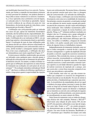 417
um imobilizador funcional (brace) no cotovelo. Teorica-
mente, por limitar a expansão da musculatura extensora
no terço proximal do antebraço, isto poderia diminuir a
força sobre as áreas vulneráveis ou sensíveis. Geralmen-
te, o brace apresenta cinco centímetros (cm) de largura,
e é colocado entre 4 e 5cm distal ao epicôndilo. Apesar
de existir evidência de sua eficácia do ponto de vista
biomecânico, ela inexiste do ponto de vista clínico, como
demonstrado por Kroslak e Murrell(15)
.
A infiltração com corticosteroide pode ser indicada
nos casos em que, apesar do tratamento fisioterápico
instituído, não há melhora da dor, impossibilitando, des-
ta forma, que o paciente inicie os exercícios de reabili-
tação. A infiltração deve ser realizada no ERCC, em um
ponto logo anterior e discretamente distal ao epicôndilo
lateral. A realização de mais de duas infiltrações pode
ser danosa devido aos efeitos adversos relacionados às
infiltrações peritendíneas com corticosteroide como ne-
crose, atrofia tecidual e consequente ruptura tendínea.
Para evitar essas complicações, a infiltração não deve
ser intratendinosa nem muito superficial (Figura 3)(16)
.
Existem poucos trabalhos randomizados que possam
ser utilizados como parâmetro para a decisão quanto à
utilização de corticosteroide no tratamento da epicondili-
te lateral do cotovelo. No entanto, os dados existentes su-
gerem que as infiltrações são superiores às outras formas
de tratamento nas avaliações em curto prazo de até seis
semanas(17)
. Na avaliação sistemática realizada por Smidt
et al(17)
não houve evidência de diferença significativa a
médio e longo prazo quanto à superioridade das injeções
locais com corticosteroide. Da mesma forma, a literatura
não nos permite concluir qual seria o tipo e a dosagem
ideal do corticosteroide a ser utilizado nas infiltrações.
Há pouco tempo, a infiltração com toxina botulínica
foi proposta como uma nova modalidade de tratamento.
Seu princípio consiste em permitir a cicatrização tecidual
em um ambiente de menos tensão causada pela parali-
sia parcial dos extensores, devido à ação anticolinérgica
dessa medicação. Dois trabalhos recentemente publi-
cados compararam a injeção de toxina botulínica com
placebo. Wong et al(18)
relataram melhores resultados em
relação à dor em 12 semanas com o grupo submetido à
medicação comparado ao placebo. Hayton et al(19)
, em
outra publicação, não observaram diferenças após três
meses. Em ambos os trabalhos, a fraqueza de extensão
dos dedos e do punho causada pela toxina botulínica
afetou de alguma forma os trabalhadores manuais.
Independentemente do tratamento instituído, uma vez
que se tenha conseguido o controle da dor, o paciente
iniciará o alongamento e o ganho da amplitude articular
do punho e cotovelo, seguido de exercícios isométricos
e isocinéticos. Não existindo dor, inicia-se o processo de
reforço muscular, recomendando-se a utilização de um
brace para controle da expansão muscular. O paciente
realizará exercícios e estará autorizado a retornar à prá-
tica esportiva ou atividade laborativa quando for capaz
de realizar exercícios de repetição até o cansaço, sem
que ocorra dor e exista força muscular comparável aos
níveis que precederam a epicondilite.
Cabe ressaltar, mais uma vez, que não existem tra-
balhos que comparem os exercícios de alongamento e
reforço muscular ao uso de placebo. No caso de retorno à
prática do tênis, é fundamental que o paciente seja orien-
tado. A circunferência da empunhadura deverá ser igual
à distância da prega palmar proximal à ponta do dedo
anular ao longo do seu bordo radial (Figura 4). Deve-se
recomendar medidas capazes de diminuir a trepidação
que se transmite ao cotovelo com a utilização de raquetes
leves, de grafite, preferencialmente, com menos pressão
no encordoamento ou maior número de fibras.
Outra forma de tratamento seria as ondas de choque,
cuja eficácia tem sido estudada. Pettrone e McCall(20)
observaram uma redução de pelo menos 50% da dor
em 64% dos pacientes submetidos a esse tipo de terapia.
Por outro lado, Haake et al(21)
, em estudo prospecti-
vo, demonstraram que as ondas de choque não foram
eficazes. Em uma revisão da literatura, Buchbinder et
al(22)
concluíram que o benefício da terapia com onda
Figura 3 – Ilustração da localização ideal para a realização da infiltração com corticos-
teroide para a epicondilite lateral.
Rev Bras Ortop. 2012;47(4):414-20
EPICONDILITE LATERAL DO COTOVELO
 