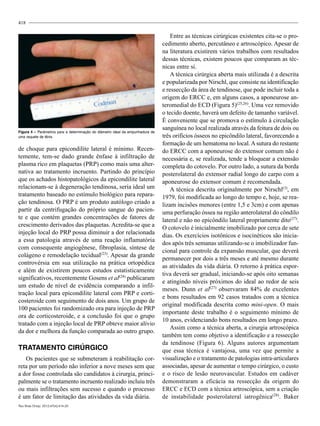 418
de choque para epicondilite lateral é mínimo. Recen-
temente, tem-se dado grande ênfase à infiltração de
plasma rico em plaquetas (PRP) como mais uma alter-
nativa ao tratamento incruento. Partindo do princípio
que os achados histopatológicos da epicondilite lateral
relacionam-se à degeneração tendinosa, seria ideal um
tratamento baseado no estímulo biológico para repara-
ção tendinosa. O PRP é um produto autólogo criado a
partir da centrifugação do próprio sangue do pacien-
te e que contém grandes concentrações de fatores de
crescimento derivados das plaquetas. Acredita-se que a
injeção local do PRP possa diminuir a dor relacionada
a essa patologia através de uma reação inflamatória
com consequente angiogênese, fibroplasia, síntese de
colágeno e remodelação tecidual(23)
. Apesar da grande
controvérsia em sua utilização na prática ortopédica
e além de existirem poucos estudos estatisticamente
significativos, recentemente Gosens et al(24)
publicaram
um estudo de nível de evidência comparando a infil-
tração local para epicondilite lateral com PRP e corti-
costeroide com seguimento de dois anos. Um grupo de
100 pacientes foi randomizado ora para injeção de PRP
ora de corticosteroide, e a conclusão foi que o grupo
tratado com a injeção local de PRP obteve maior alívio
da dor e melhora da função comparada ao outro grupo.
Tratamento cirúrgico
Os pacientes que se submeteram à reabilitação cor-
reta por um período não inferior a nove meses sem que
a dor fosse controlada são candidatos à cirurgia, princi-
palmente se o tratamento incruento realizado incluiu três
ou mais infiltrações sem sucesso e quando o processo
é um fator de limitação das atividades da vida diária.
Entre as técnicas cirúrgicas existentes cita-se o pro-
cedimento aberto, percutâneo e artroscópico. Apesar de
na literatura existirem vários trabalhos com resultados
dessas técnicas, existem poucos que comparam as téc-
nicas entre si.
A técnica cirúrgica aberta mais utilizada é a descrita
e popularizada por Nirschl, que consiste na identificação
e ressecção da área de tendinose, que pode incluir toda a
origem do ERCC e, em alguns casos, a aponeurose an-
teromedial do ECD (Figura 5)(25,26)
. Uma vez removido
o tecido doente, haverá um defeito de tamanho variável.
É conveniente que se promova o estímulo à circulação
sanguínea no local realizada através da feitura de dois ou
três orifícios ósseos no epicôndilo lateral, favorecendo a
formação de um hematoma no local. A sutura do restante
do ERCC com a aponeurose do extensor comum não é
necessária e, se realizada, tende a bloquear a extensão
completa do cotovelo. Por outro lado, a sutura da borda
posterolateral do extensor radial longo do carpo com a
aponeurose do extensor comum é recomendada.
A técnica descrita originalmente por Nirschl(3)
, em
1979, foi modificada ao longo do tempo e, hoje, se rea-
lizam incisões menores (entre 1,5 e 3cm) e com apenas
uma perfuração óssea na região anterolateral do côndilo
lateral e não no epicôndilo lateral propriamente dito(27)
.
O cotovelo é inicialmente imobilizado por cerca de sete
dias. Os exercícios isotônicos e isocinéticos são inicia-
dos após três semanas utilizando-se o imobilizador fun-
cional para controle da expansão muscular, que deverá
permanecer por dois a três meses e até mesmo durante
as atividades da vida diária. O retorno à prática espor-
tiva deverá ser gradual, iniciando-se após oito semanas
e atingindo níveis próximos do ideal ao redor de seis
meses. Dunn et al(27)
observaram 84% de excelentes
e bons resultados em 92 casos tratados com a técnica
original modificada descrita como mini-open. O mais
importante deste trabalho é o seguimento mínimo de
10 anos, evidenciando bons resultados em longo prazo.
Assim como a técnica aberta, a cirurgia artroscópica
também tem como objetivo a identificação e a ressecção
da tendinose (Figura 6). Alguns autores argumentam
que essa técnica é vantajosa, uma vez que permite a
visualização e o tratamento de patologias intra-articulares
associadas, apesar de aumentar o tempo cirúrgico, o custo
e o risco de lesão neurovascular. Estudos em cadáver
demonstraram a eficácia na ressecção da origem do
ERCC e ECD com a técnica artroscópica, sem a criação
de instabilidade posterolateral iatrogênica(28)
. Baker
Figura 4 – Parâmetros para a determinação do diâmetro ideal da empunhadura de
uma raquete de tênis.
Rev Bras Ortop. 2012;47(4):414-20
 