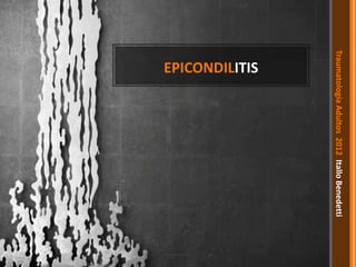 Epicondilitis
