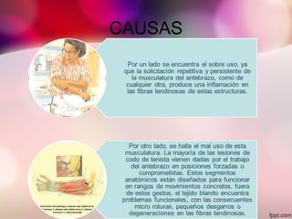 CAUSAS
 