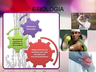 ETIOLOGIA
 