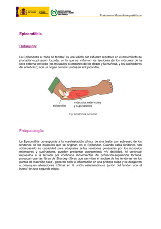                                                                                     
                                                                                          Trastornos Musculoesqueléticos
Epicondilitis
Definición:
La Epicondilitis o “codo de tenista” es una lesión por esfuerzo repetitivo en el movimiento de
pronación-supinación forzada, en la que se inflaman los tendones de los músculos de la
cara externa del codo (los músculos extensores de los dedos y la muñeca, y los supinadores
del antebrazo) con un origen común (unión) en el Epicóndilo.
Fig. Anatomía del codo
Fisiopatología:
La Epicondilitis corresponde a la manifestación clínica de una lesión por sobreuso de los
tendones de los músculos que se originan en el Epicóndilo. Cuando estos tendones han
sobrepasado su capacidad para adaptarse a las tensiones generadas por los músculos
extensores y supinadores, pueden presentar acortamiento y/o debilidad. Al continuar
expuestos a la tensión por continuos movimientos de pronación-supinación forzada,
provocan que las fibras de Sharpey (fibras que permiten el anclaje de los tendones en los
puntos de inserción ósea), generen dolor e inflamación en una primera etapa y se desgarren
o provoquen alteraciones tróficas en la unión osteotendinosa (unión del tendón con el
hueso) en una segunda etapa.
 
 