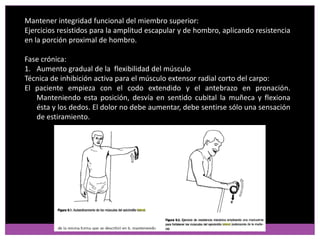 Fortalecimiento del músculo:
Cuando no haya dolor en toda la amplitud de movimiento
1.Ejercicios isométricos, ejerciendo r...