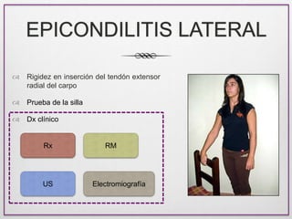 EPICONDILITIS LATERAL
 Rigidez en inserción del tendón extensor
radial del carpo
 Prueba de la silla
 Dx clínico
Rx
US
...