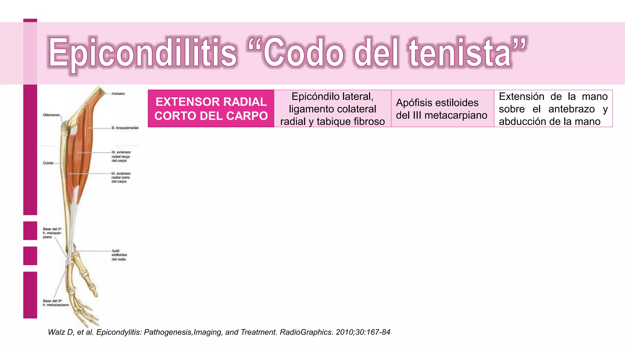 Epicondilitis y epitrocleitis | PPSX