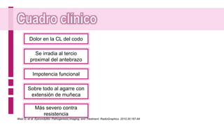Dolor en la CL del codo
Se irradia al tercio
proximal del antebrazo
Impotencia funcional
Sobre todo al agarre con
extensión de muñeca
Más severo contra
resistencia
Walz D, et al. Epicondylitis: Pathogenesis,Imaging, and Treatment. RadioGraphics. 2010;30:167-84
 