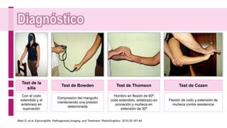 Test de la
silla
Test de Bowden
Con el codo
extendido y el
antebrazo en
supinación
Compresión del manguito
manteniendo una presión
determinada
Test de Thomson
Hombro en flexión de 60º,
codo extendido, antebrazo en
pronación y muñeca en
extensión de 30º
Test de Cozen
Flexión de codo y extensión de
muñeca contra resistencia
Walz D, et al. Epicondylitis: Pathogenesis,Imaging, and Treatment. RadioGraphics. 2010;30:167-84
 