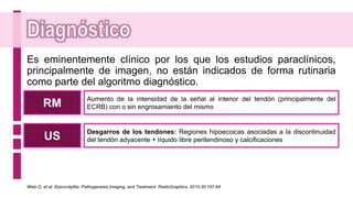 Es eminentemente clínico por los que los estudios paraclínicos,
principalmente de imagen, no están indicados de forma rutinaria
como parte del algoritmo diagnóstico.
RM Aumento de la intensidad de la señal al interior del tendón (principalmente del
ECRB) con o sin engrosamiento del mismo
US Desgarros de los tendones: Regiones hipoecoicas asociadas a la discontinuidad
del tendón adyacente + líquido libre peritendinoso y calcificaciones
Walz D, et al. Epicondylitis: Pathogenesis,Imaging, and Treatment. RadioGraphics. 2010;30:167-84
 