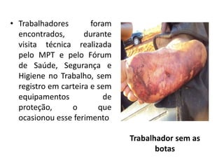 • Trabalhadores foram
encontrados, durante
visita técnica realizada
pelo MPT e pelo Fórum
de Saúde, Segurança e
Higiene no Trabalho, sem
registro em carteira e sem
equipamentos de
proteção, o que
ocasionou esse ferimento
Trabalhador sem as
botas
 