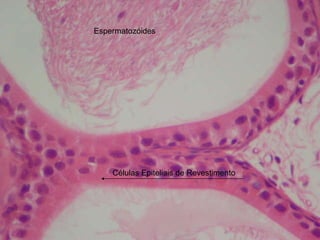 Espermatozóides Células Epiteliais de Revestimento 