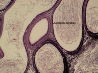 Complexo de Golgi 