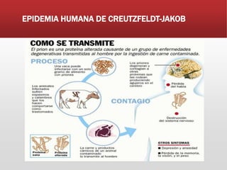 EPIDEMIA HUMANA DE CREUTZFELDT-JAKOB
 