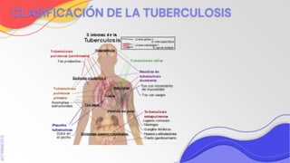 SLIDESMANIA.COM
CLASIFICACIÓN DE LA TUBERCULOSIS
 