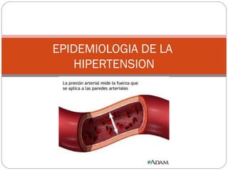 EPIDEMIOLOGIA DE LA
   HIPERTENSION
 