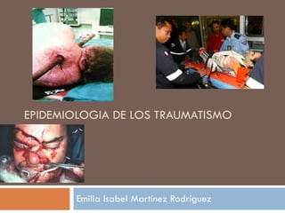 EPIDEMIOLOGIA DE LOS TRAUMATISMO Emilia Isabel Martínez Rodríguez 