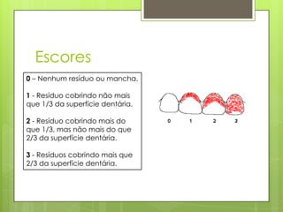 Escores
0 – Nenhum resíduo ou mancha.
1 - Resíduo cobrindo não mais
que 1/3 da superfície dentária.
2 - Resíduo cobrindo mais do
que 1/3, mas não mais do que
2/3 da superfície dentária.
3 - Resíduos cobrindo mais que
2/3 da superfície dentária.
 