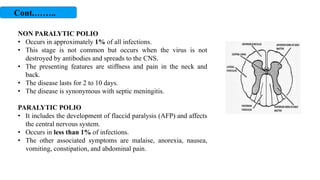 NON PARALYTIC POLIO
• Occurs in approximately 1% of all infections.
• This stage is not common but occurs when the virus is not
destroyed by antibodies and spreads to the CNS.
• The presenting features are stiffness and pain in the neck and
back.
• The disease lasts for 2 to 10 days.
• The disease is synonymous with septic meningitis.
PARALYTIC POLIO
• It includes the development of flaccid paralysis (AFP) and affects
the central nervous system.
• Occurs in less than 1% of infections.
• The other associated symptoms are malaise, anorexia, nausea,
vomiting, constipation, and abdominal pain.
Cont.……..
 