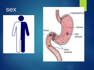 sex
 