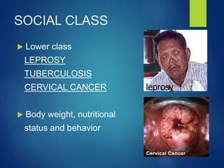 SOCIAL CLASS
 Lower class
LEPROSY
TUBERCULOSIS
CERVICAL CANCER
 Body weight, nutritional
status and behavior
leprosy
 
