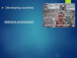  Developing countries
defective environment
Lack of sanitation
 