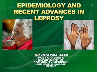 DR BHAVNA JAIN
POST GRADUATE
DEPARTMENT OF
COMMUNITY MEDICINE
LLRM MEDICAL COLLEGE,
MEERUT
1
 