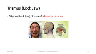 Jawed Rajar Epidemiology, Prevention & Control of Tetanus.pptx