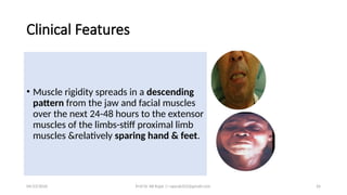 Jawed Rajar Epidemiology, Prevention & Control of Tetanus.pptx