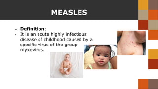 Epidemiology & Control Measures of Measles.pptx