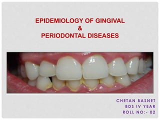 C H E T A N B A S N E T
B D S I V Y E A R
R O L L N O : - 0 2
EPIDEMIOLOGY OF GINGIVAL
&
PERIODONTAL DISEASES
 