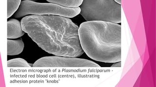 Epidemiology of malaria [autosaved] | PPTX