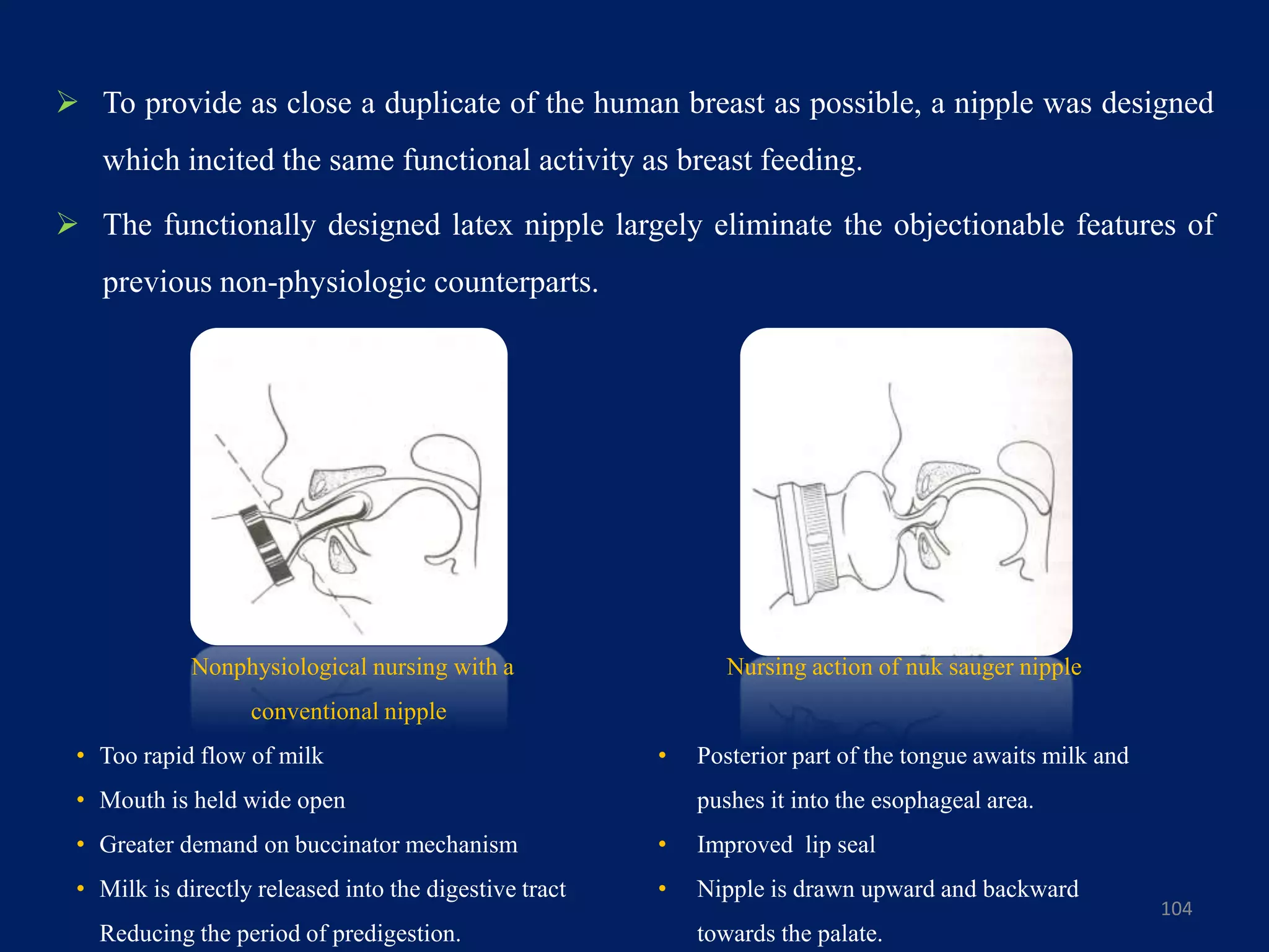  To provide as close a duplicate of the human breast as possible, a nipple was designed
which incited the same functional activity as breast feeding.
 The functionally designed latex nipple largely eliminate the objectionable features of
previous non-physiologic counterparts.
104
Nonphysiological nursing with a
conventional nipple
• Too rapid flow of milk
• Mouth is held wide open
• Greater demand on buccinator mechanism
• Milk is directly released into the digestive tract
Reducing the period of predigestion.
Nursing action of nuk sauger nipple
• Posterior part of the tongue awaits milk and
pushes it into the esophageal area.
• Improved lip seal
• Nipple is drawn upward and backward
towards the palate.
 