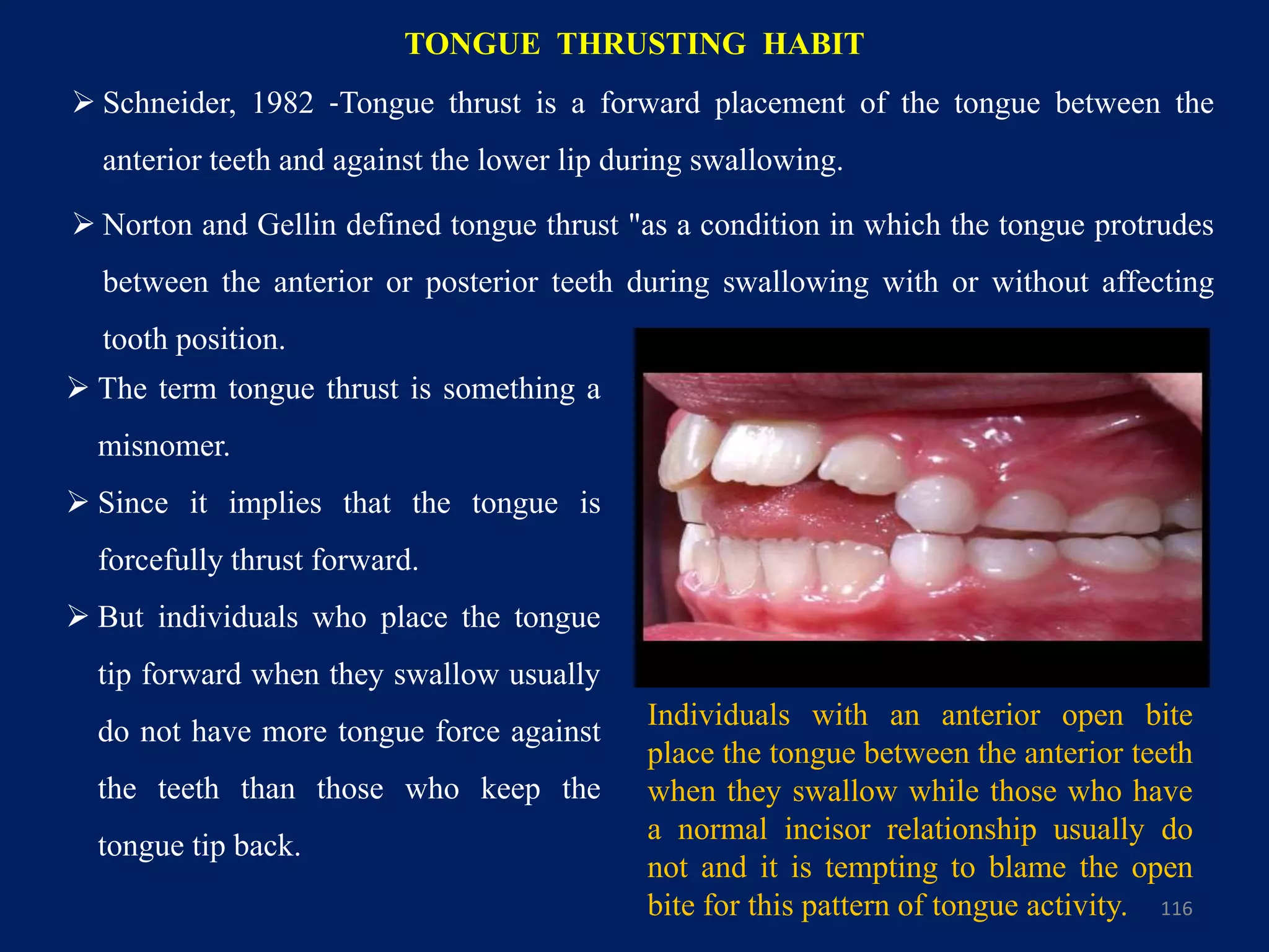 TONGUE THRUSTING HABIT
 Schneider, 1982 ‐Tongue thrust is a forward placement of the tongue between the
anterior teeth and against the lower lip during swallowing.
 Norton and Gellin defined tongue thrust "as a condition in which the tongue protrudes
between the anterior or posterior teeth during swallowing with or without affecting
tooth position.
116
 The term tongue thrust is something a
misnomer.
 Since it implies that the tongue is
forcefully thrust forward.
 But individuals who place the tongue
tip forward when they swallow usually
do not have more tongue force against
the teeth than those who keep the
tongue tip back.
Individuals with an anterior open bite
place the tongue between the anterior teeth
when they swallow while those who have
a normal incisor relationship usually do
not and it is tempting to blame the open
bite for this pattern of tongue activity.
 