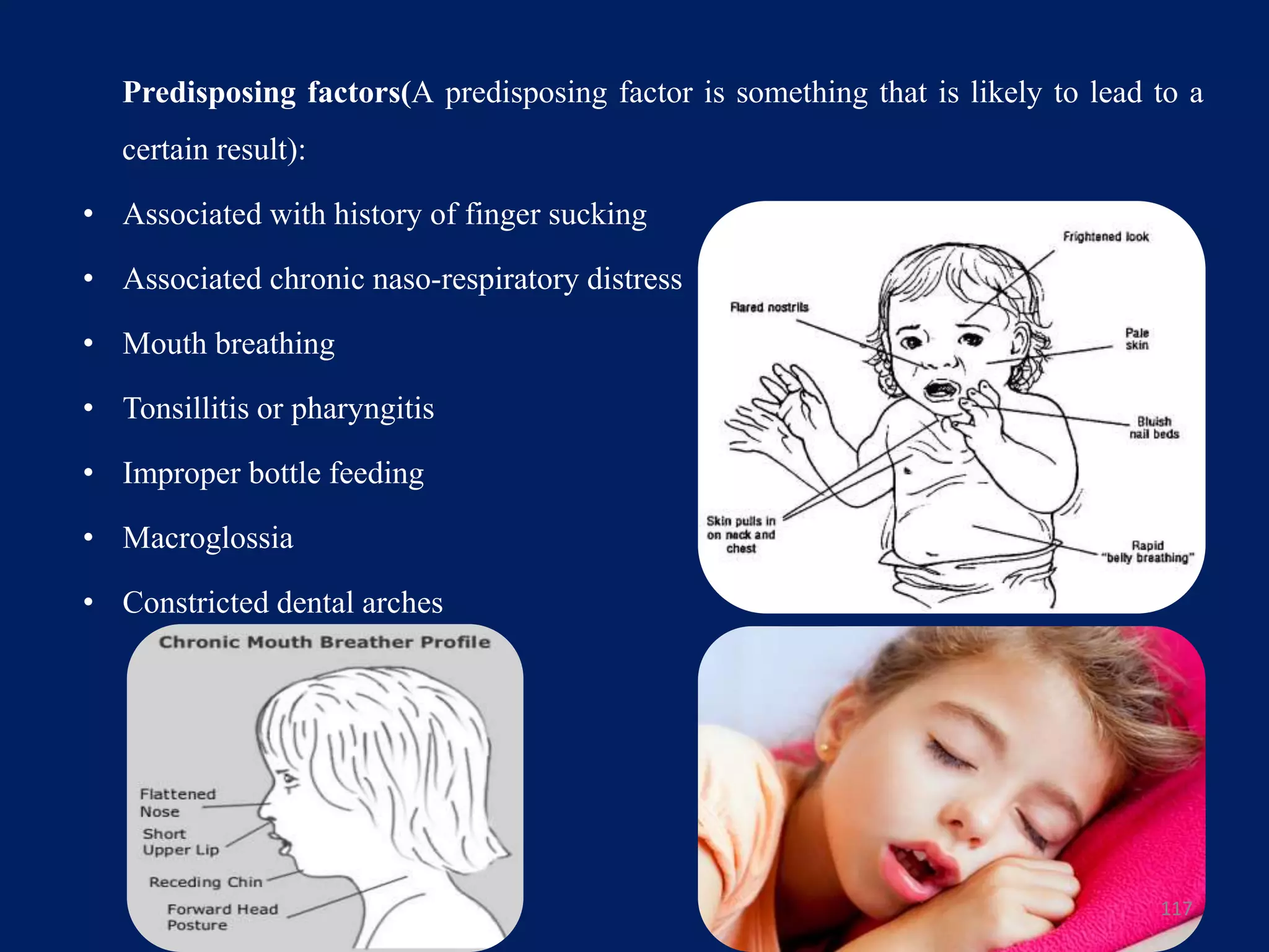 Predisposing factors(A predisposing factor is something that is likely to lead to a
certain result):
• Associated with history of finger sucking
• Associated chronic naso-respiratory distress
• Mouth breathing
• Tonsillitis or pharyngitis
• Improper bottle feeding
• Macroglossia
• Constricted dental arches
117
 