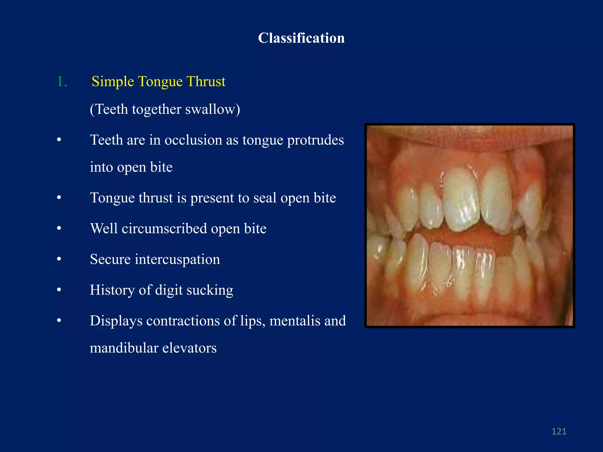 Classification
1. Simple Tongue Thrust
121
(Teeth together swallow)
• Teeth are in occlusion as tongue protrudes
into open bite
• Tongue thrust is present to seal open bite
• Well circumscribed open bite
• Secure intercuspation
• History of digit sucking
• Displays contractions of lips, mentalis and
mandibular elevators
 