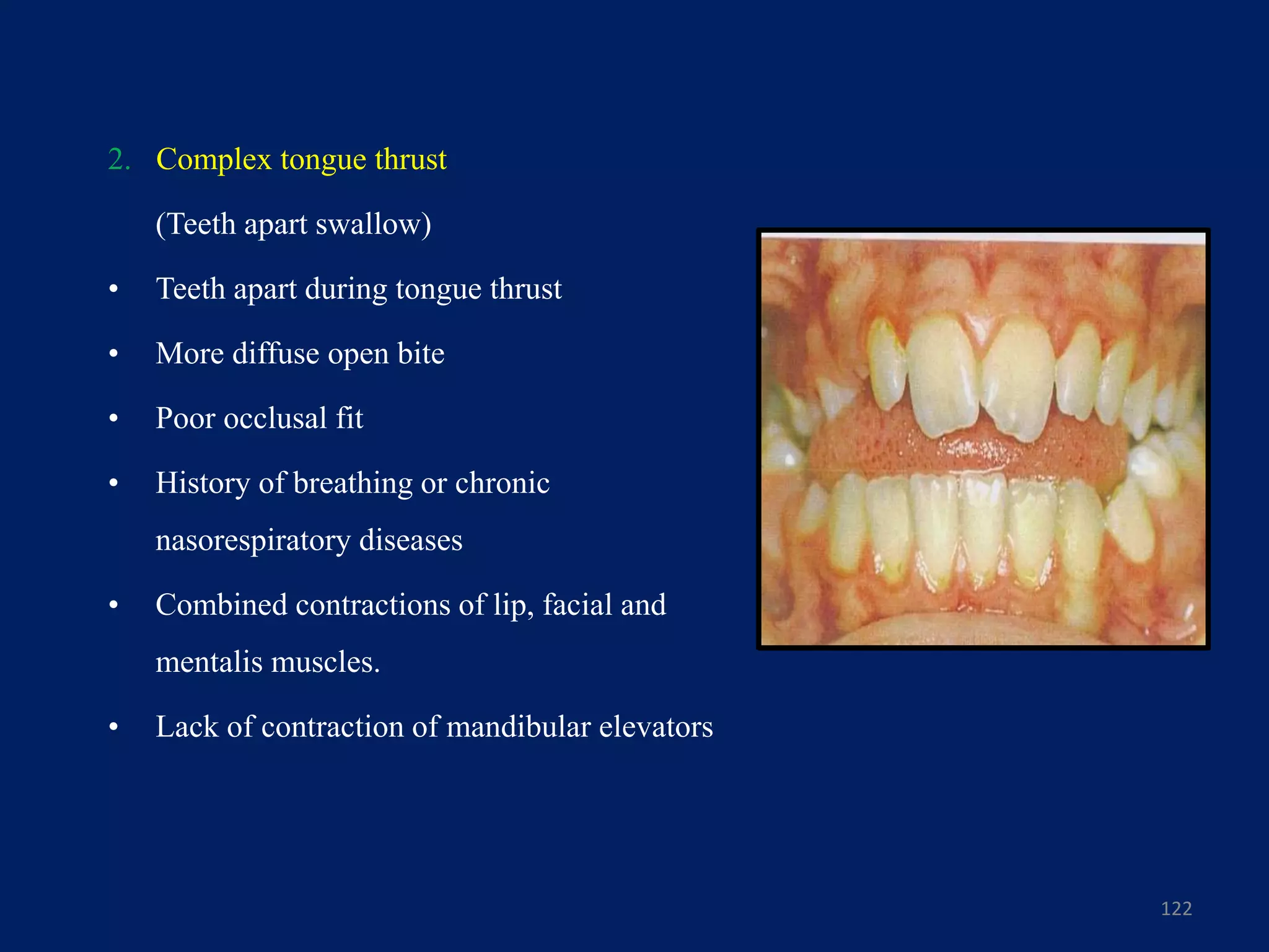 2. Complex tongue thrust
(Teeth apart swallow)
• Teeth apart during tongue thrust
• More diffuse open bite
• Poor occlusal fit
• History of breathing or chronic
nasorespiratory diseases
• Combined contractions of lip, facial and
mentalis muscles.
• Lack of contraction of mandibular elevators
122
 