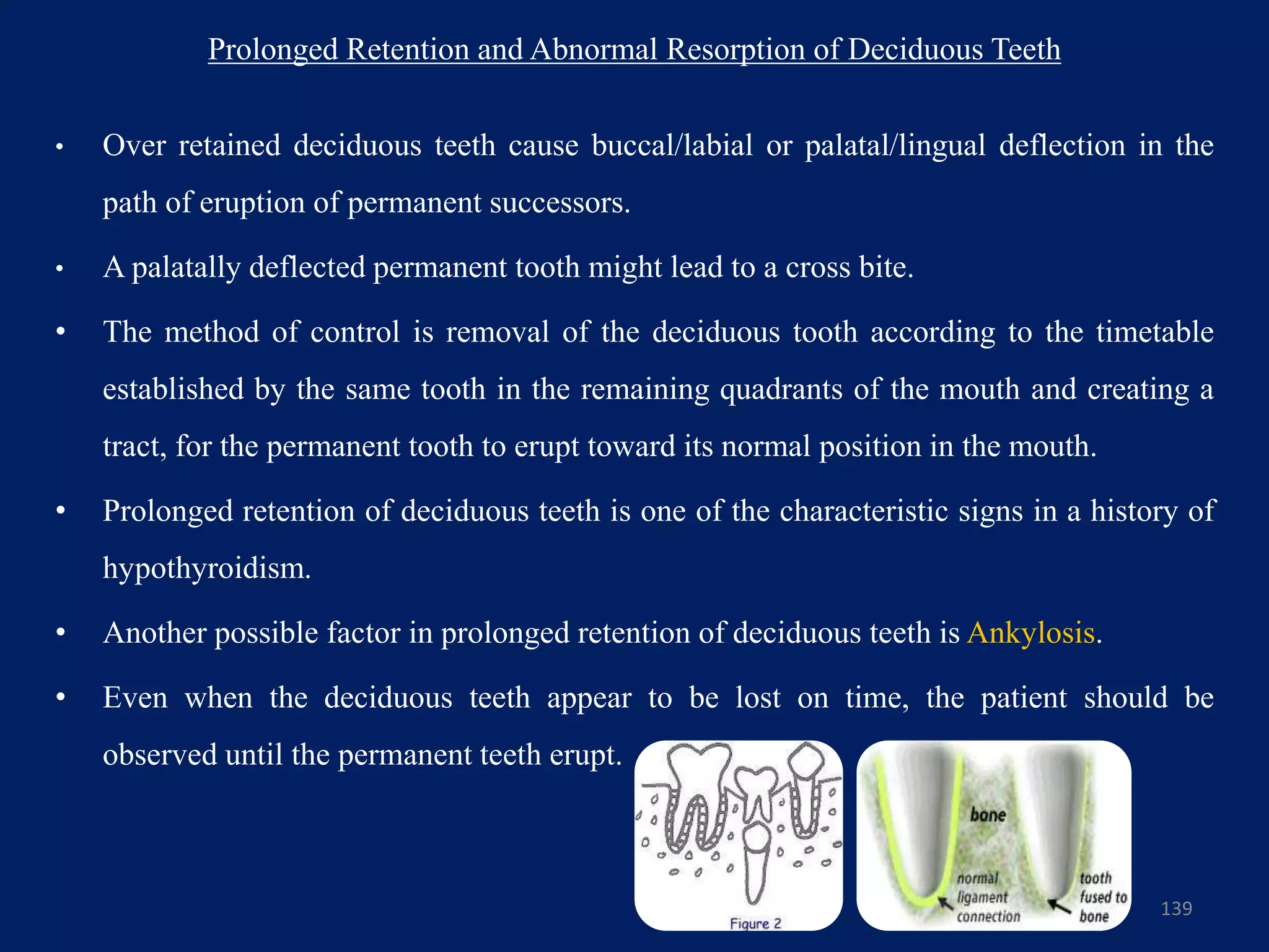 Prolonged Retention and Abnormal Resorption of Deciduous Teeth
• Over retained deciduous teeth cause buccal/labial or palatal/lingual deflection in the
path of eruption of permanent successors.
• A palatally deflected permanent tooth might lead to a cross bite.
• The method of control is removal of the deciduous tooth according to the timetable
established by the same tooth in the remaining quadrants of the mouth and creating a
tract, for the permanent tooth to erupt toward its normal position in the mouth.
• Prolonged retention of deciduous teeth is one of the characteristic signs in a history of
hypothyroidism.
• Another possible factor in prolonged retention of deciduous teeth is Ankylosis.
• Even when the deciduous teeth appear to be lost on time, the patient should be
observed until the permanent teeth erupt.
139
 