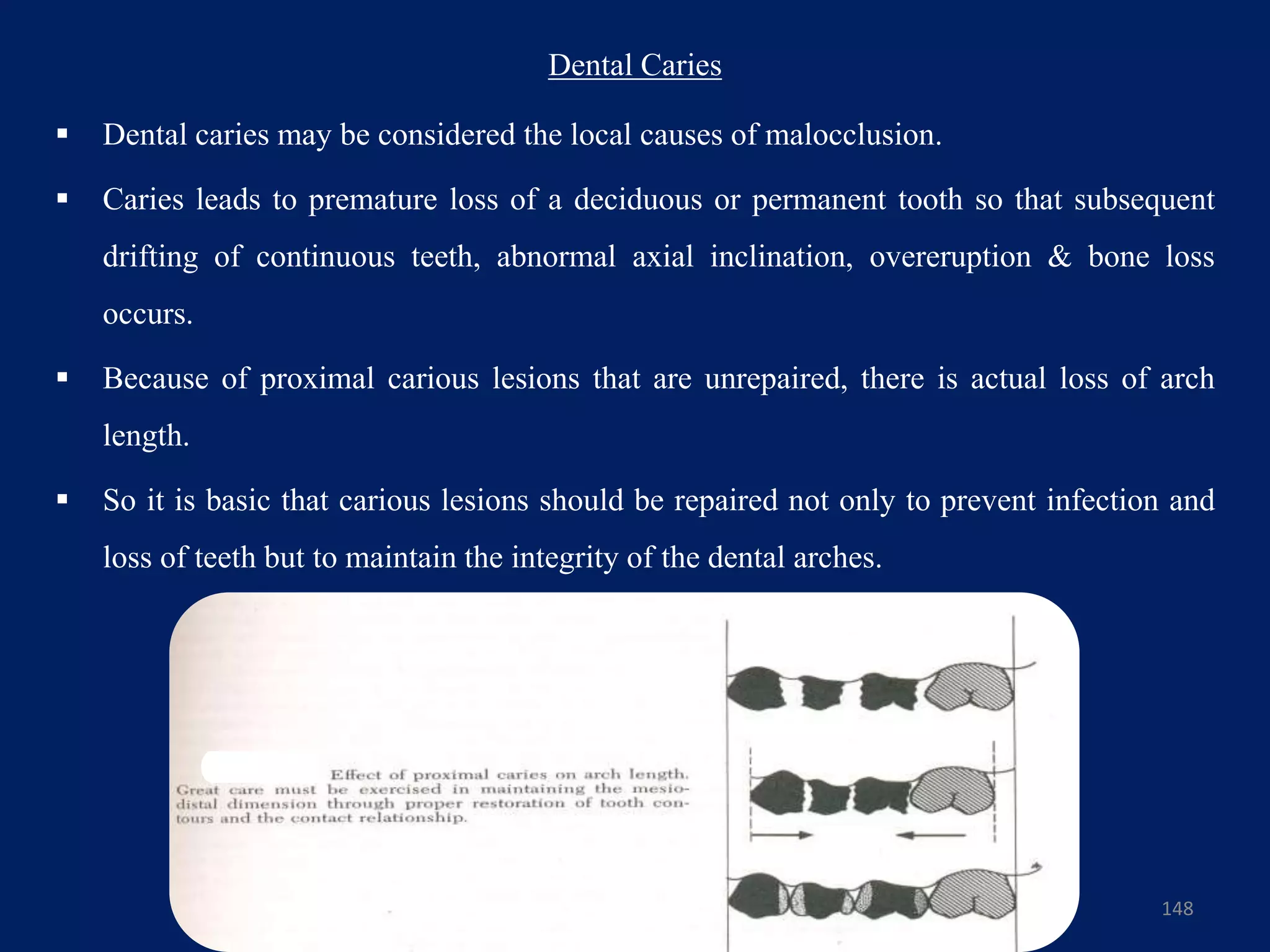 Dental Caries
 Dental caries may be considered the local causes of malocclusion.
 Caries leads to premature loss of a deciduous or permanent tooth so that subsequent
drifting of continuous teeth, abnormal axial inclination, overeruption & bone loss
occurs.
 Because of proximal carious lesions that are unrepaired, there is actual loss of arch
length.
 So it is basic that carious lesions should be repaired not only to prevent infection and
loss of teeth but to maintain the integrity of the dental arches.
148
 