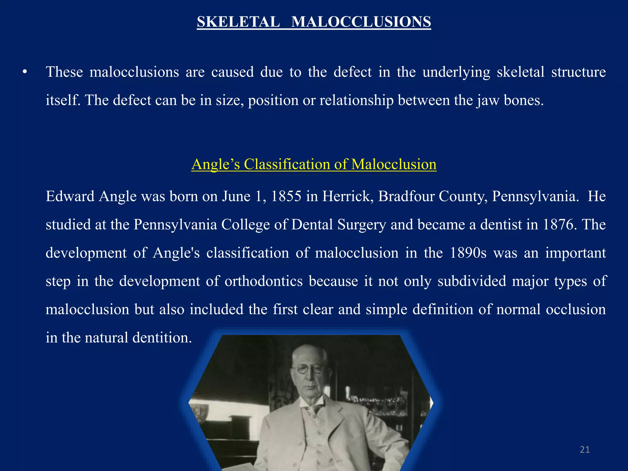 SKELETAL MALOCCLUSIONS
• These malocclusions are caused due to the defect in the underlying skeletal structure
itself. The defect can be in size, position or relationship between the jaw bones.
Angle’s Classification of Malocclusion
Edward Angle was born on June 1, 1855 in Herrick, Bradfour County, Pennsylvania. He
studied at the Pennsylvania College of Dental Surgery and became a dentist in 1876. The
development of Angle's classification of malocclusion in the 1890s was an important
step in the development of orthodontics because it not only subdivided major types of
malocclusion but also included the first clear and simple definition of normal occlusion
in the natural dentition.
21
 