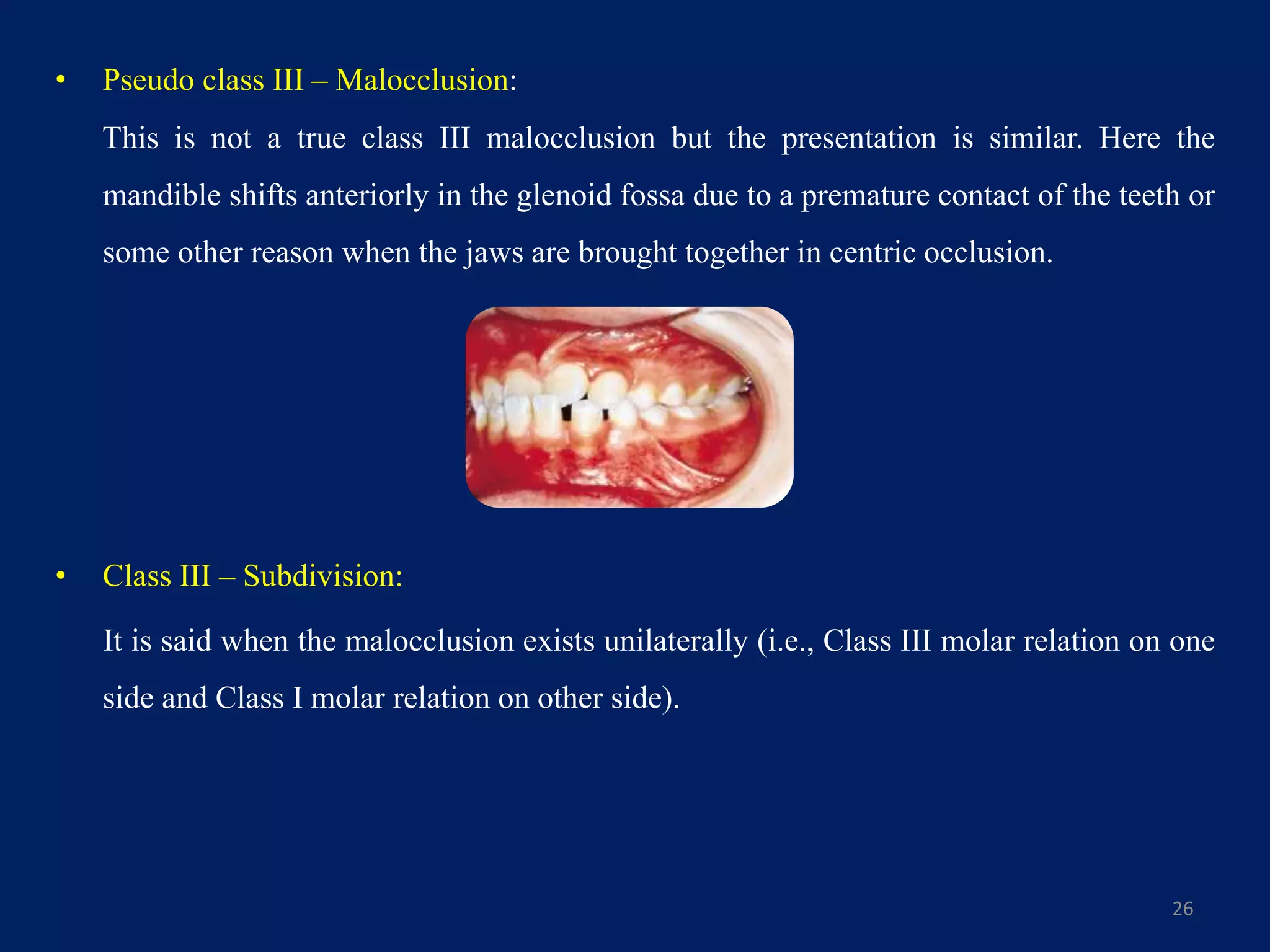 • Pseudo class III – Malocclusion:
This is not a true class III malocclusion but the presentation is similar. Here the
mandible shifts anteriorly in the glenoid fossa due to a premature contact of the teeth or
some other reason when the jaws are brought together in centric occlusion.
• Class III – Subdivision:
It is said when the malocclusion exists unilaterally (i.e., Class III molar relation on one
side and Class I molar relation on other side).
26
 