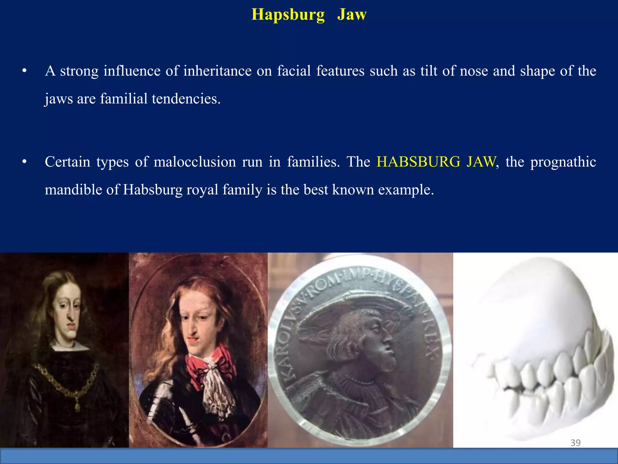 • A strong influence of inheritance on facial features such as tilt of nose and shape of the
jaws are familial tendencies.
• Certain types of malocclusion run in families. The HABSBURG JAW, the prognathic
mandible of Habsburg royal family is the best known example.
39
Hapsburg Jaw
 
