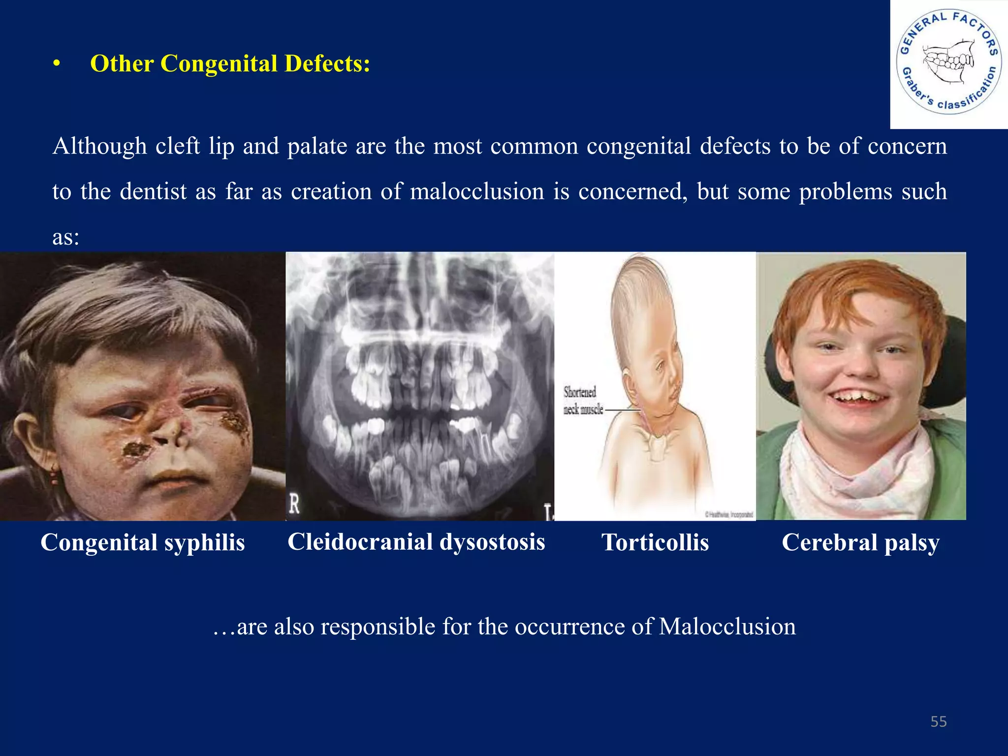• Other Congenital Defects:
Although cleft lip and palate are the most common congenital defects to be of concern
to the dentist as far as creation of malocclusion is concerned, but some problems such
as:
55
Cerebral palsyTorticollisCleidocranial dysostosisCongenital syphilis
…are also responsible for the occurrence of Malocclusion
 