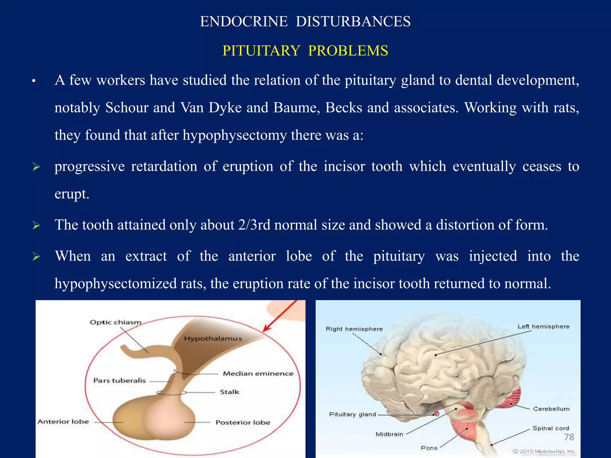 ENDOCRINE DISTURBANCES
PITUITARY PROBLEMS
• A few workers have studied the relation of the pituitary gland to dental development,
notably Schour and Van Dyke and Baume, Becks and associates. Working with rats,
they found that after hypophysectomy there was a:
 progressive retardation of eruption of the incisor tooth which eventually ceases to
erupt.
 The tooth attained only about 2/3rd normal size and showed a distortion of form.
 When an extract of the anterior lobe of the pituitary was injected into the
hypophysectomized rats, the eruption rate of the incisor tooth returned to normal.
78
 