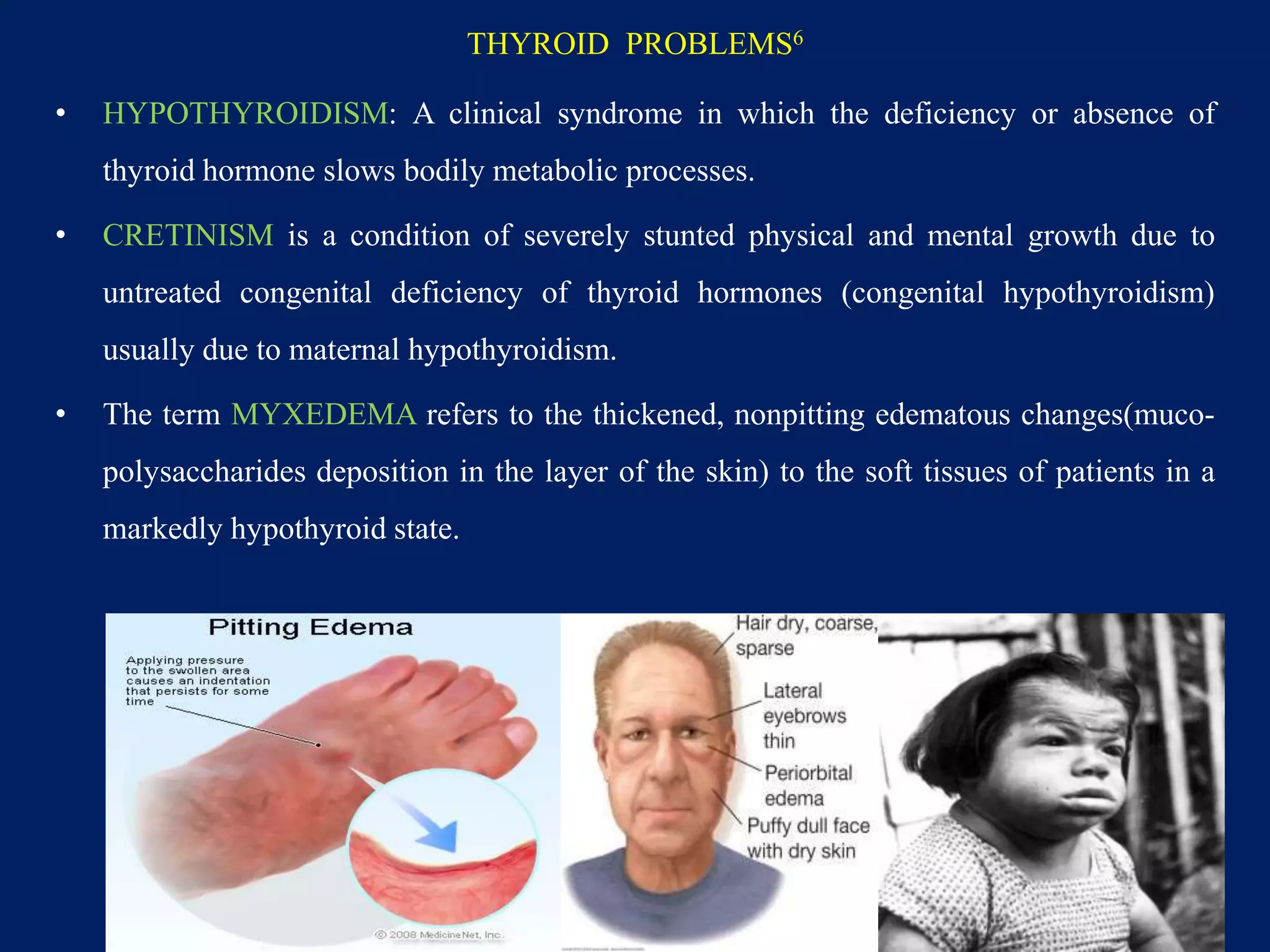 THYROID PROBLEMS6
• HYPOTHYROIDISM: A clinical syndrome in which the deficiency or absence of
thyroid hormone slows bodily metabolic processes.
• CRETINISM is a condition of severely stunted physical and mental growth due to
untreated congenital deficiency of thyroid hormones (congenital hypothyroidism)
usually due to maternal hypothyroidism.
• The term MYXEDEMA refers to the thickened, nonpitting edematous changes(muco-
polysaccharides deposition in the layer of the skin) to the soft tissues of patients in a
markedly hypothyroid state.
83
 