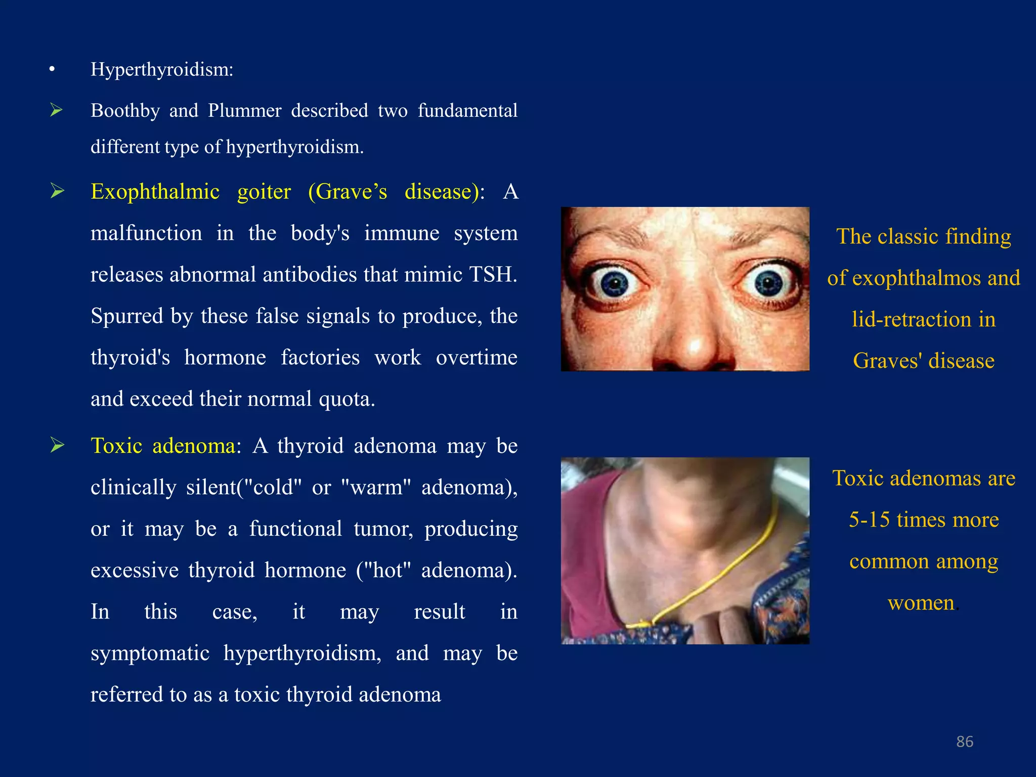• Hyperthyroidism:
 Boothby and Plummer described two fundamental
different type of hyperthyroidism.
 Exophthalmic goiter (Grave’s disease): A
malfunction in the body's immune system
releases abnormal antibodies that mimic TSH.
Spurred by these false signals to produce, the
thyroid's hormone factories work overtime
and exceed their normal quota.
 Toxic adenoma: A thyroid adenoma may be
clinically silent("cold" or "warm" adenoma),
or it may be a functional tumor, producing
excessive thyroid hormone ("hot" adenoma).
In this case, it may result in
symptomatic hyperthyroidism, and may be
referred to as a toxic thyroid adenoma
86
The classic finding
of exophthalmos and
lid-retraction in
Graves' disease
Toxic adenomas are
5-15 times more
common among
women.
 