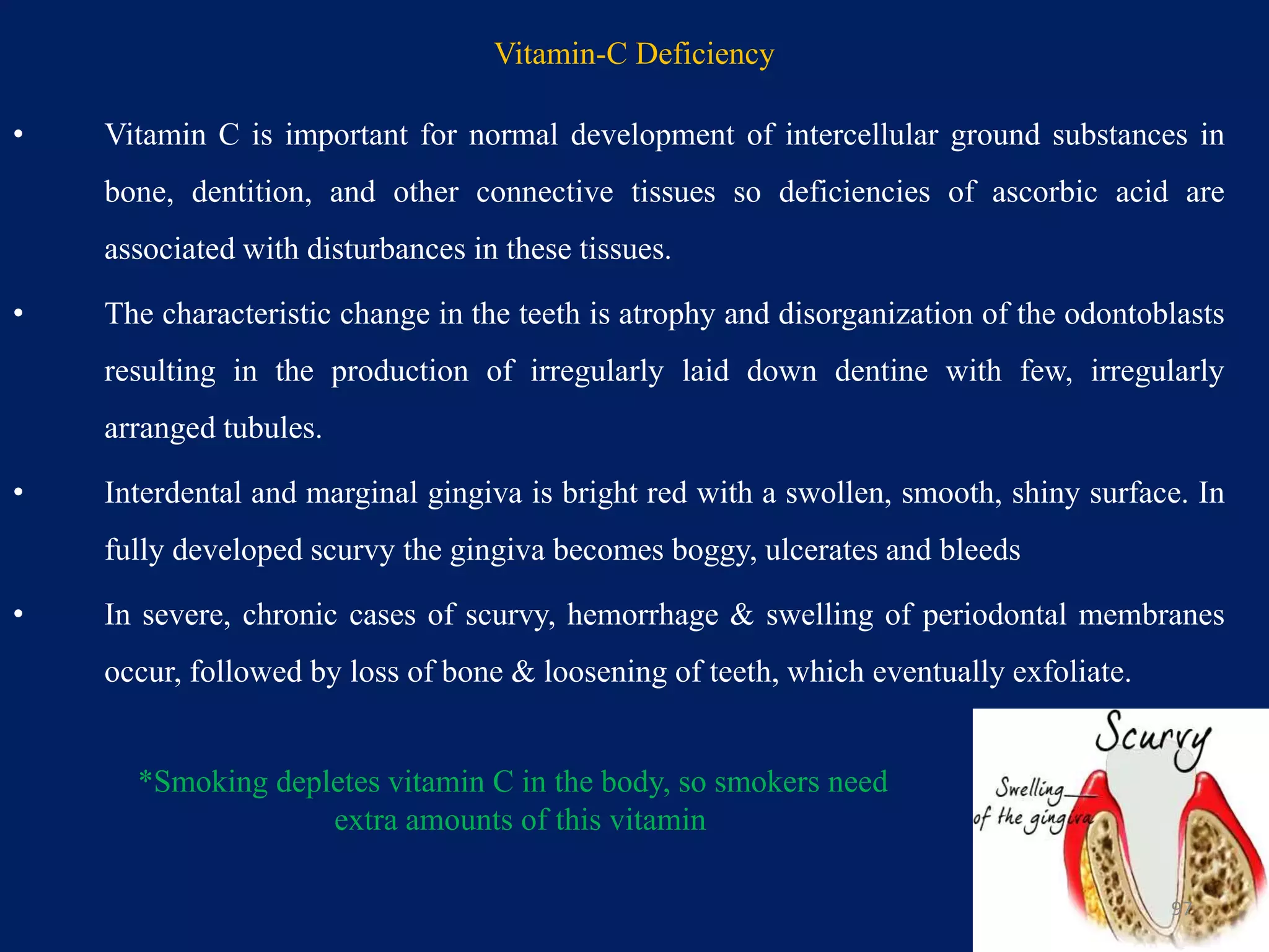 Vitamin-C Deficiency
• Vitamin C is important for normal development of intercellular ground substances in
bone, dentition, and other connective tissues so deficiencies of ascorbic acid are
associated with disturbances in these tissues.
• The characteristic change in the teeth is atrophy and disorganization of the odontoblasts
resulting in the production of irregularly laid down dentine with few, irregularly
arranged tubules.
• Interdental and marginal gingiva is bright red with a swollen, smooth, shiny surface. In
fully developed scurvy the gingiva becomes boggy, ulcerates and bleeds
• In severe, chronic cases of scurvy, hemorrhage & swelling of periodontal membranes
occur, followed by loss of bone & loosening of teeth, which eventually exfoliate.
97
*Smoking depletes vitamin C in the body, so smokers need
extra amounts of this vitamin
 