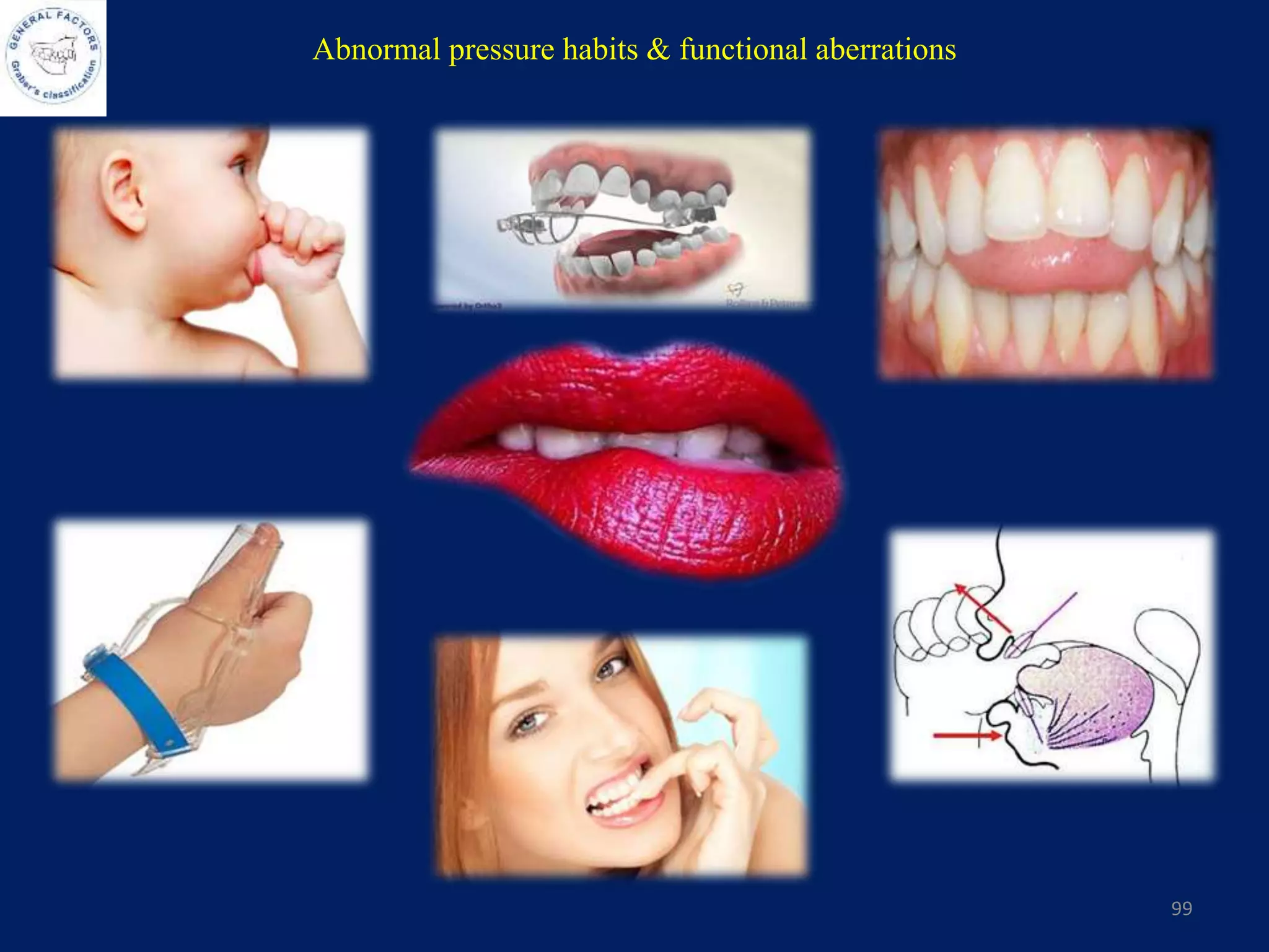 Abnormal pressure habits & functional aberrations
99
 