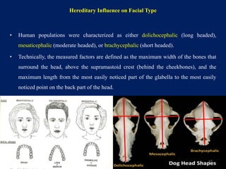 Dolichocephalic Races Epidemiology of malocclusion | PPTX