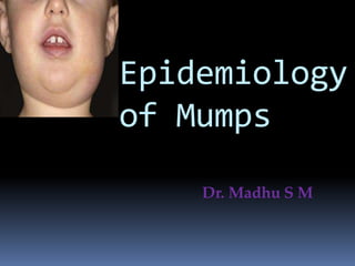 Epidemiology
of Mumps
Dr. Madhu S M
 
