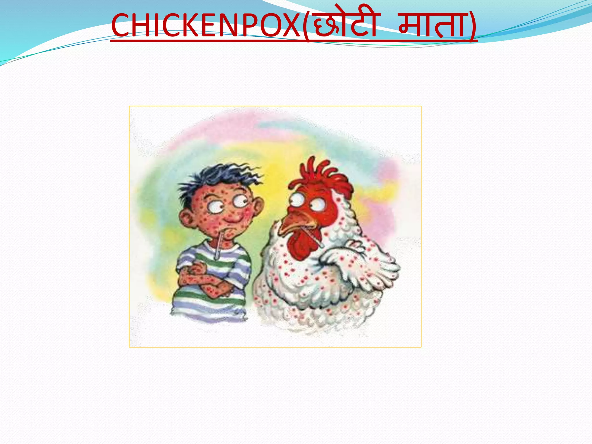 CHICKENPOX(छोटी माता)
 